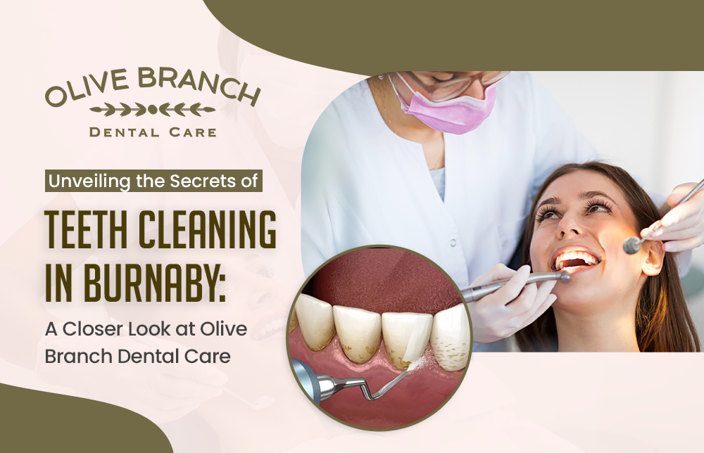 Unveiling the Secrets of Teeth Cleaning in Burnaby: A Closer Look at Olive Branch Dental Care